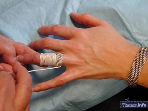 Как снять кольцо с помощью нити
