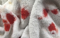 Как вывести пятна крови с полотенца, свежей и засохшей