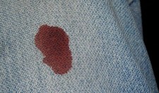 Кровь на джинсах